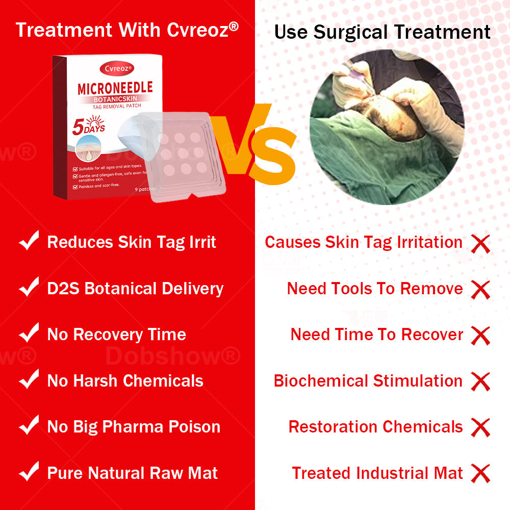 𝐂𝐯𝐫𝐞𝐨𝐳®𝐌𝐢𝐜𝐫𝐨𝐍𝐞𝐞𝐝𝐥𝐞 𝐁𝐨𝐭𝐚𝐧𝐢𝐜𝐒𝐤𝐢𝐧 𝐓𝐚𝐠 𝐑𝐞𝐦𝐨𝐯𝐚𝐥 𝐏𝐚𝐭𝐜𝐡