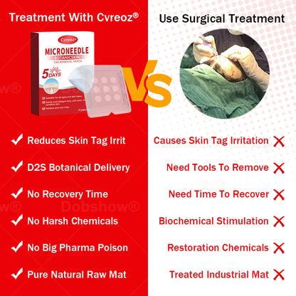 𝐂𝐯𝐫𝐞𝐨𝐳®𝐌𝐢𝐜𝐫𝐨𝐍𝐞𝐞𝐝𝐥𝐞 𝐁𝐨𝐭𝐚𝐧𝐢𝐜𝐒𝐤𝐢𝐧 𝐓𝐚𝐠 𝐑𝐞𝐦𝐨𝐯𝐚𝐥 𝐏𝐚𝐭𝐜𝐡