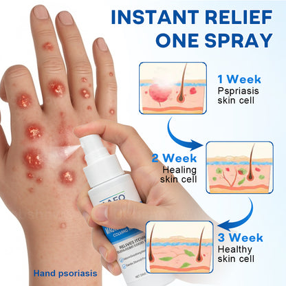 🔥Final 3 Hours: 80% OFF: AAFQ® Magnesium & Herbs Calming Spray⚕️ FDA Certified (for the treatment of psoriasis and eczema, improvement of bacterial infections in the genital area, treatment of acne and warts, eliminates psoriasis and eczema, etc.)