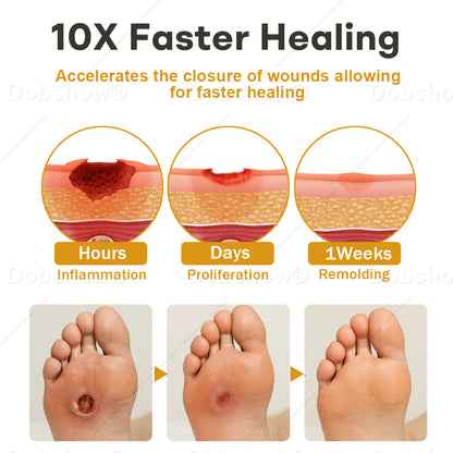 Healrize® GlucoShield Bee Venom Wound Spray🔥