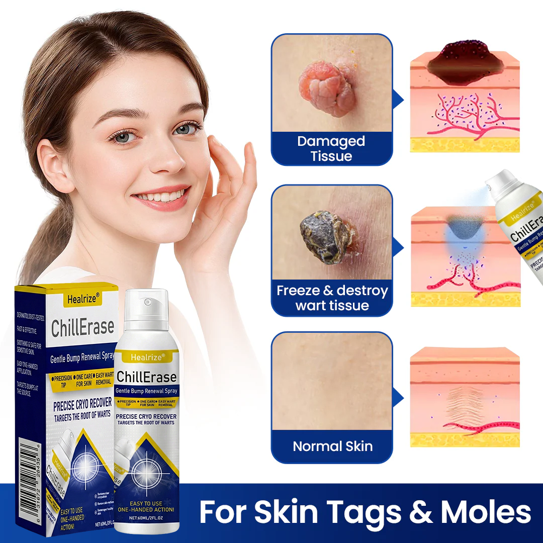 ❄️Healrize®ChillErase Gentle Bump Renewal Spray — Pain-Free, Acid-Free Gentle Wart Removal