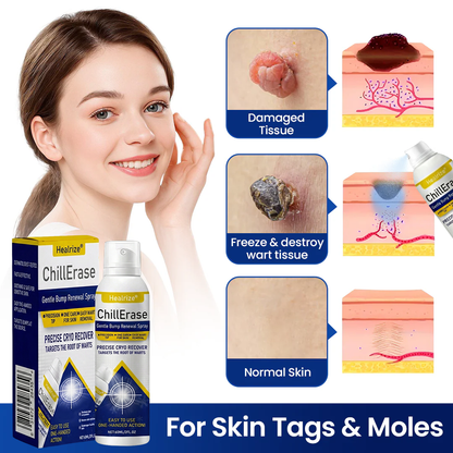 ❄️Healrize®ChillErase Gentle Bump Renewal Spray — Pain-Free, Acid-Free Gentle Wart Removal