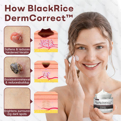 👨‍⚕️🌿Healrize® BlackRice DermCorrect™ Wart Recovery Cream| Suitable for all skin types