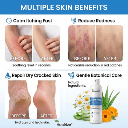 🌿Healrize® Magnesium Botanical Spray – Advanced Skin Recovery for Psoriasis & Eczema | Rapid Soothing, Steroid-Free