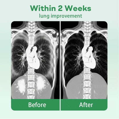 ✅Official Store| Cvreoz® Herbal Lung Cleansing Inhaier(🫁Cough, wheezing, shortness of breath, sputum, stuffy nose, bronchitis, bronchitis, allergy symptoms, lung discomfort💝)