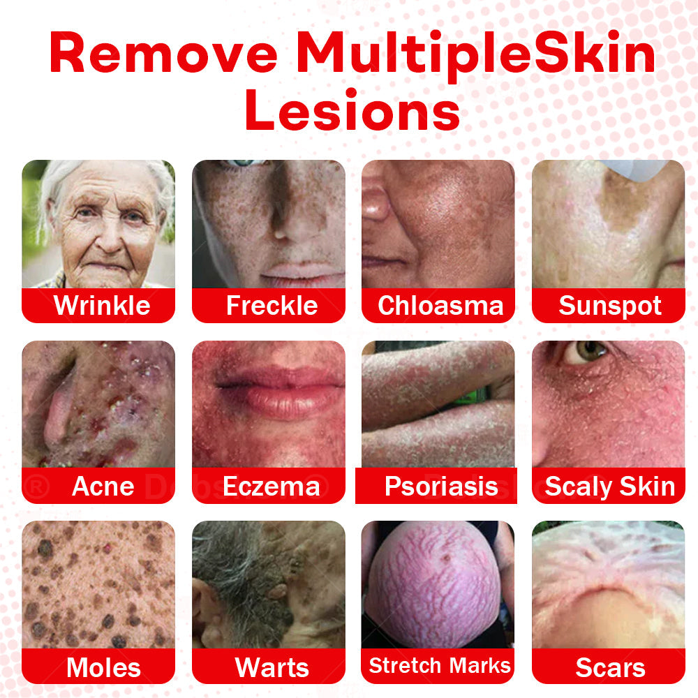 𝐂𝐯𝐫𝐞𝐨𝐳®𝐌𝐢𝐜𝐫𝐨𝐍𝐞𝐞𝐝𝐥𝐞 𝐁𝐨𝐭𝐚𝐧𝐢𝐜𝐒𝐤𝐢𝐧 𝐓𝐚𝐠 𝐑𝐞𝐦𝐨𝐯𝐚𝐥 𝐏𝐚𝐭𝐜𝐡