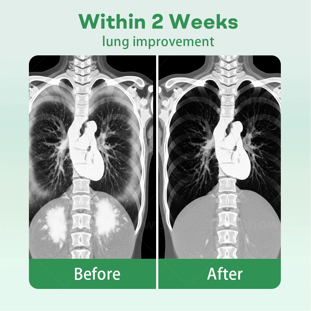 ✅Official Store| Healrize® 𝐇𝐞𝐫𝐛𝐚𝐥 𝐋𝐮𝐧𝐠 𝐂𝐥𝐞𝐚𝐧𝐬𝐢𝐧𝐠 𝐈𝐧𝐡𝐚𝐢𝐞𝐫(🫁Cough, wheezing, shortness of breath, sputum, stuffy nose, bronchitis, bronchitis, allergy symptoms, lung discomfort💝)