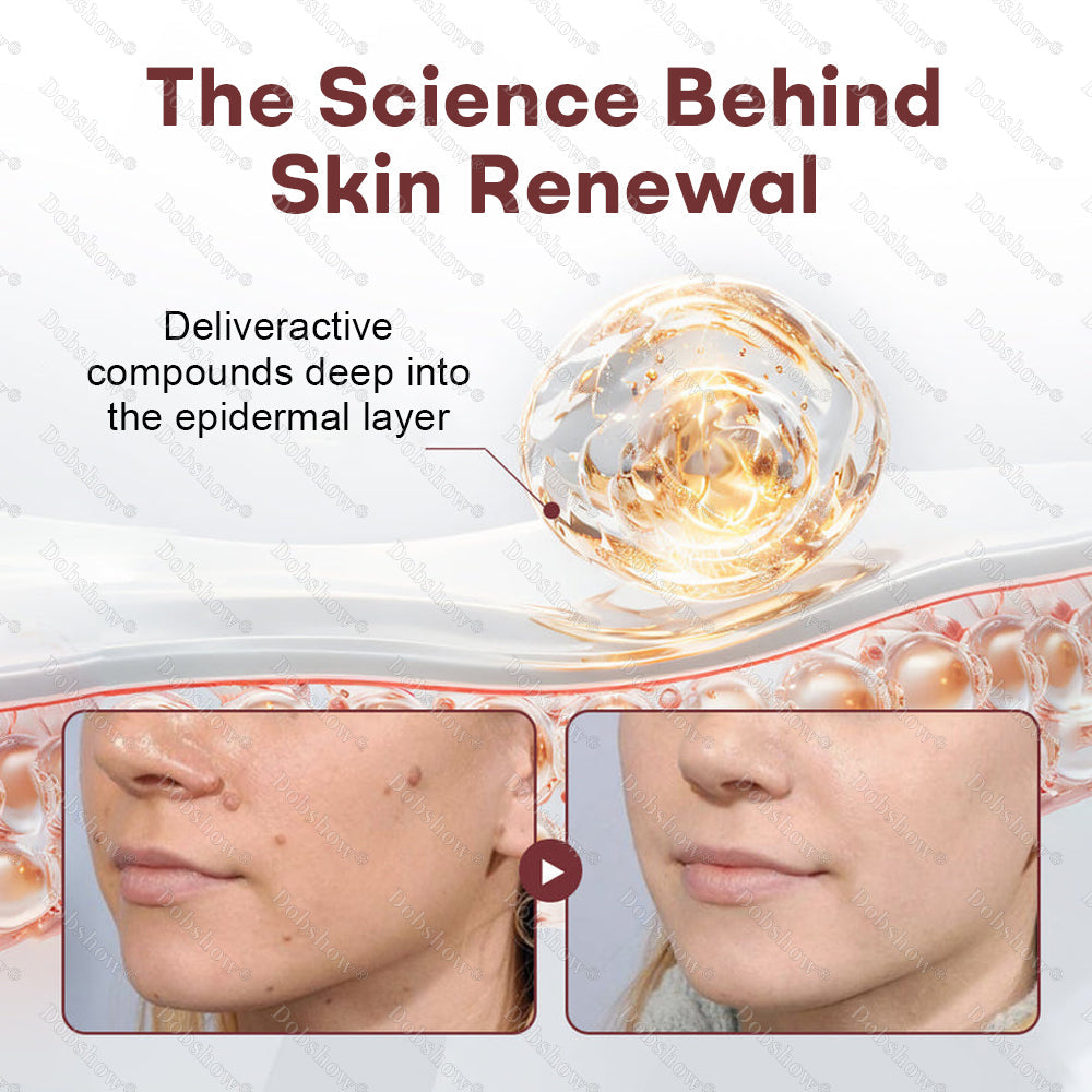 👨‍⚕️🌿Healrize® BlackRice DermCorrect™ Wart Recovery Cream| Suitable for all skin types