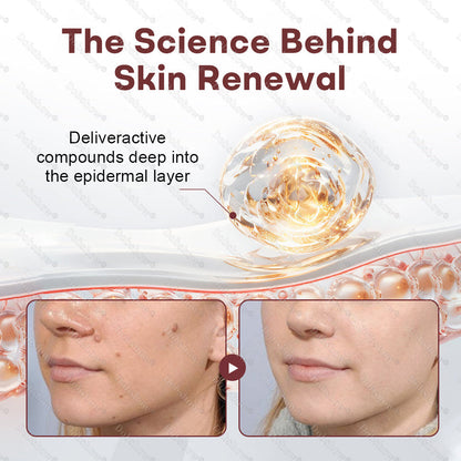 👨‍⚕️🌿Healrize® BlackRice DermCorrect™ Wart Recovery Cream| Suitable for all skin types