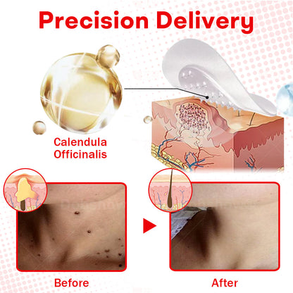 𝐂𝐯𝐫𝐞𝐨𝐳®𝐌𝐢𝐜𝐫𝐨𝐍𝐞𝐞𝐝𝐥𝐞 𝐁𝐨𝐭𝐚𝐧𝐢𝐜𝐒𝐤𝐢𝐧 𝐓𝐚𝐠 𝐑𝐞𝐦𝐨𝐯𝐚𝐥 𝐏𝐚𝐭𝐜𝐡