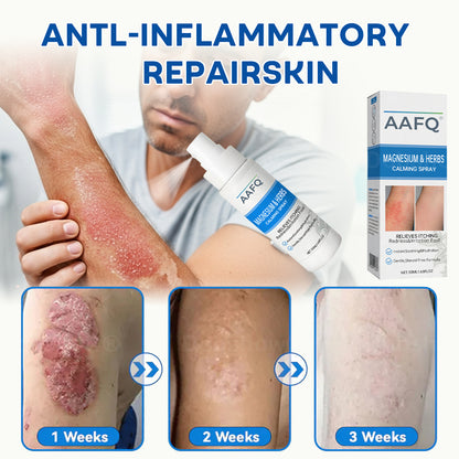 🔥Final 3 Hours: 80% OFF: AAFQ® Magnesium & Herbs Calming Spray⚕️ FDA Certified (for the treatment of psoriasis and eczema, improvement of bacterial infections in the genital area, treatment of acne and warts, eliminates psoriasis and eczema, etc.)