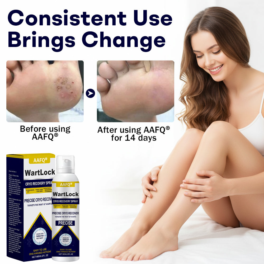 🔥𝘾𝙮𝙗𝙚𝙧 𝙈𝙤𝙣𝙙𝙖𝙮 𝙎𝙖𝙡𝙚 | AAFQ® WartLock CRYO RECOVERY SPRAY