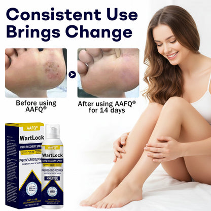 🔥𝘾𝙮𝙗𝙚𝙧 𝙈𝙤𝙣𝙙𝙖𝙮 𝙎𝙖𝙡𝙚 | AAFQ® WartLock CRYO RECOVERY SPRAY