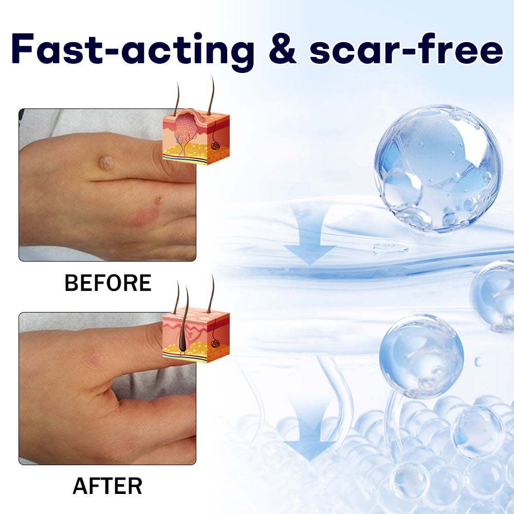 🔥𝘾𝙮𝙗𝙚𝙧 𝙈𝙤𝙣𝙙𝙖𝙮 𝙎𝙖𝙡𝙚 | AAFQ® WartLock CRYO RECOVERY SPRAY