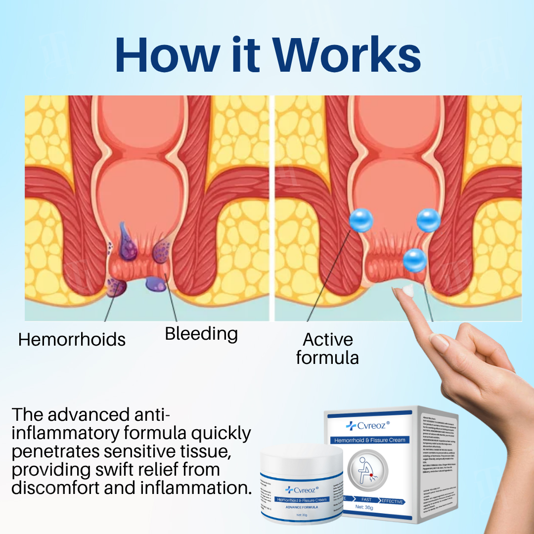 🔥 𝙉𝙚𝙬 𝙔𝙚𝙖𝙧 𝙎𝙖𝙡𝙚 | Cvreoz® Hemorrhoid & Fissure Cream