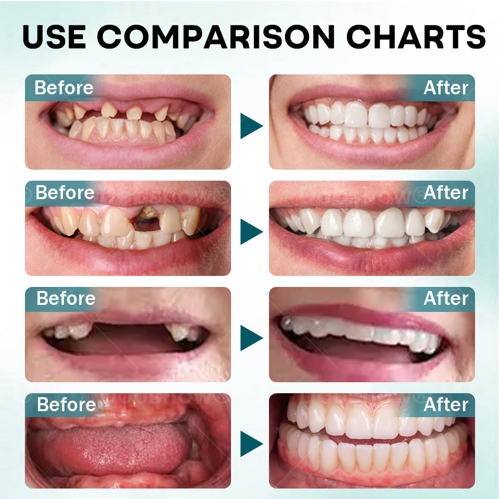 🎇𝙉𝙚𝙬𝙔𝙚𝙖𝙧 𝙎𝙖𝙡𝙚 | Dobshow® FirmHold Denture Adhesive