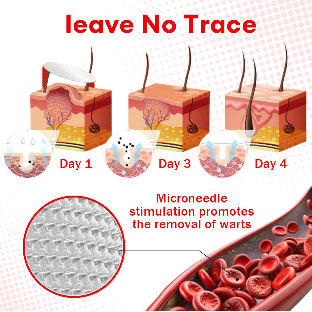 𝐂𝐯𝐫𝐞𝐨𝐳®𝐌𝐢𝐜𝐫𝐨𝐍𝐞𝐞𝐝𝐥𝐞 𝐁𝐨𝐭𝐚𝐧𝐢𝐜𝐒𝐤𝐢𝐧 𝐓𝐚𝐠 𝐑𝐞𝐦𝐨𝐯𝐚𝐥 𝐏𝐚𝐭𝐜𝐡