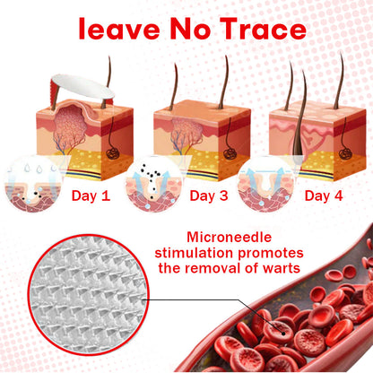 𝐂𝐯𝐫𝐞𝐨𝐳®𝐌𝐢𝐜𝐫𝐨𝐍𝐞𝐞𝐝𝐥𝐞 𝐁𝐨𝐭𝐚𝐧𝐢𝐜𝐒𝐤𝐢𝐧 𝐓𝐚𝐠 𝐑𝐞𝐦𝐨𝐯𝐚𝐥 𝐏𝐚𝐭𝐜𝐡