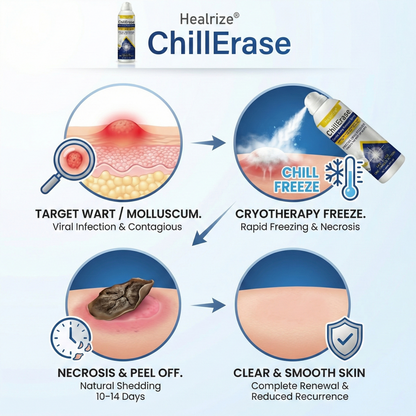 ❄️Healrize®ChillErase Gentle Bump Renewal Spray — Pain-Free, Acid-Free Gentle Wart Removal