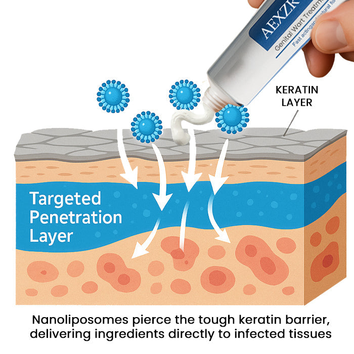 AEXZR® HPV Genital Wart Treatment Cream