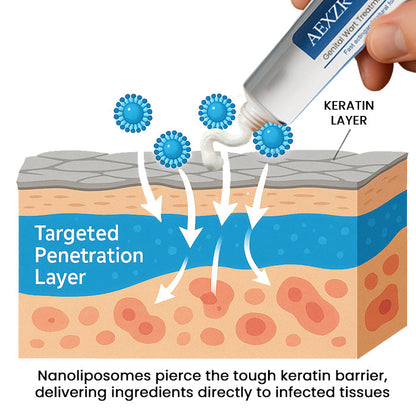 AEXZR® HPV Genital Wart Treatment Cream