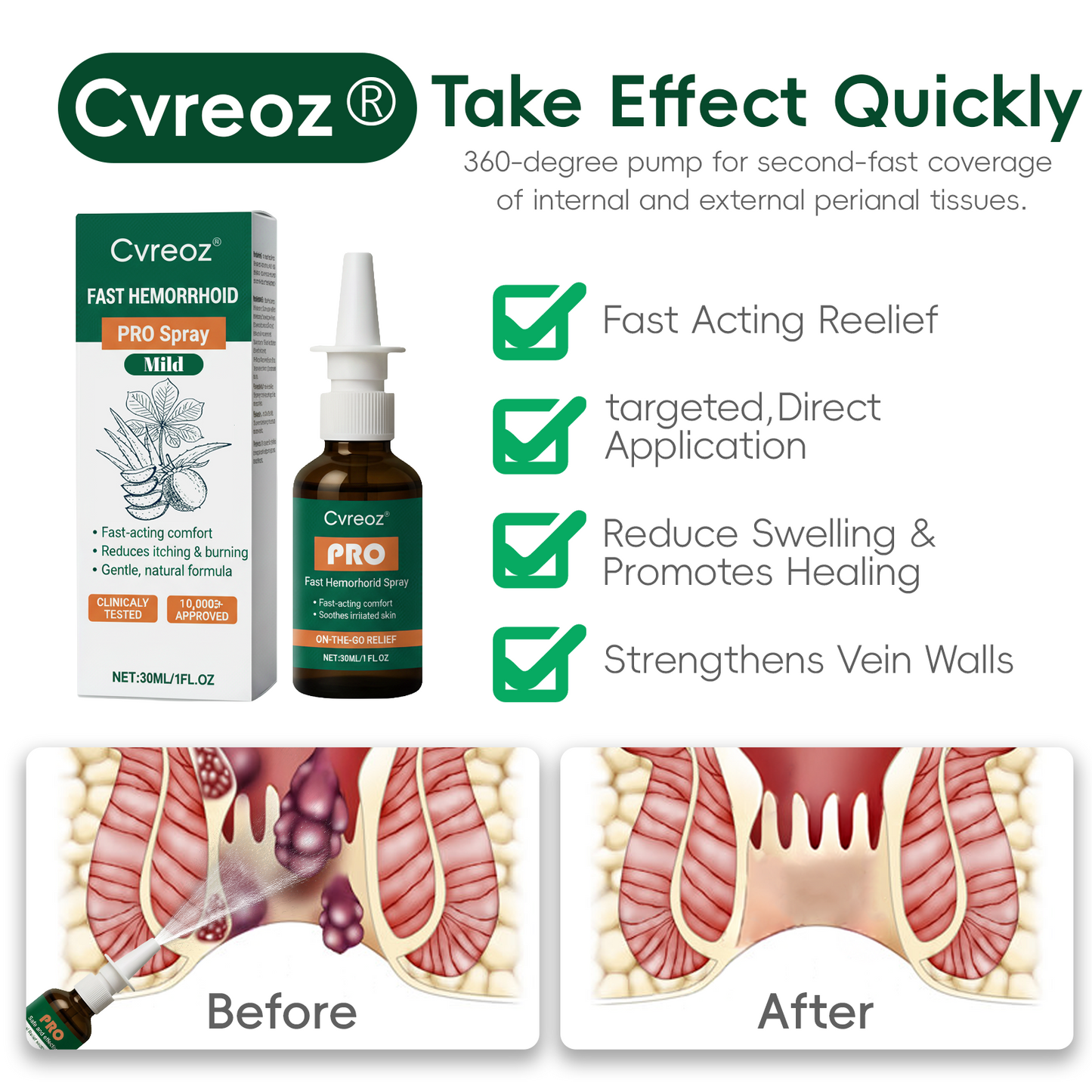 🔥𝘾𝙮𝙗𝙚𝙧 𝙈𝙤𝙣𝙙𝙖𝙮 𝙎𝙖𝙡𝙚 | Cvreoz® Fast Hemorrhoid PRO Spray